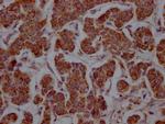 MCT1 Antibody in Immunohistochemistry (Paraffin) (IHC (P))