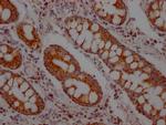 MCT1 Antibody in Immunohistochemistry (Paraffin) (IHC (P))