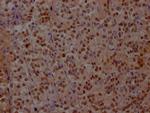 ISL1 Antibody in Immunohistochemistry (Paraffin) (IHC (P))