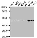 AGTR2 Antibody in Western Blot (WB)