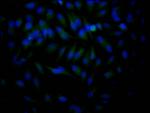 HDAC2 Antibody in Immunocytochemistry (ICC/IF)