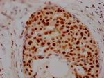 HDAC2 Antibody in Immunohistochemistry (Paraffin) (IHC (P))