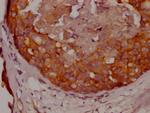 Protein APC Antibody in Immunohistochemistry (Paraffin) (IHC (P))