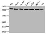 Glucocorticoid Receptor Antibody in Western Blot (WB)