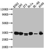 CDK2 Antibody in Western Blot (WB)