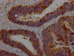 Galectin 3 Antibody in Immunohistochemistry (Paraffin) (IHC (P))