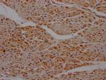 SDHB Antibody in Immunohistochemistry (Paraffin) (IHC (P))