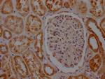 SDHB Antibody in Immunohistochemistry (Paraffin) (IHC (P))