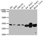 SDHB Antibody in Western Blot (WB)