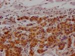 MAPKAPK2 Antibody in Immunohistochemistry (Paraffin) (IHC (P))