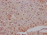 MAPKAPK2 Antibody in Immunohistochemistry (Paraffin) (IHC (P))