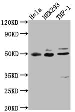 MAPKAPK2 Antibody in Western Blot (WB)