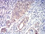 ACSS1 Antibody in Immunohistochemistry (Paraffin) (IHC (P))