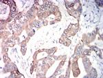 ADAM10 Antibody in Immunohistochemistry (Paraffin) (IHC (P))