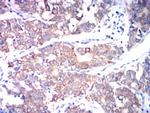 ADAM10 Antibody in Immunohistochemistry (Paraffin) (IHC (P))