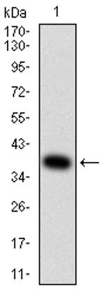 beta-2 Adrenergic Receptor Antibody in Western Blot (WB)