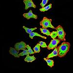 ARF1 Antibody in Immunocytochemistry (ICC/IF)