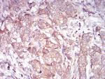 ARF1 Antibody in Immunohistochemistry (Paraffin) (IHC (P))