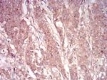 ARF1 Antibody in Immunohistochemistry (Paraffin) (IHC (P))