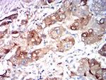 ASGR2 Antibody in Immunohistochemistry (Paraffin) (IHC (P))