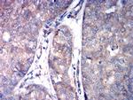 ASGR2 Antibody in Immunohistochemistry (Paraffin) (IHC (P))