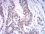 ASH2L Antibody in Immunohistochemistry (Paraffin) (IHC (P))