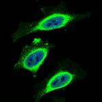 beta-2 Microglobulin Antibody in Immunocytochemistry (ICC/IF)