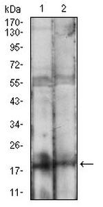 BAD Antibody in Western Blot (WB)