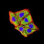 BNIP3 Antibody in Immunocytochemistry (ICC/IF)