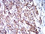 BNIP3 Antibody in Immunohistochemistry (Paraffin) (IHC (P))