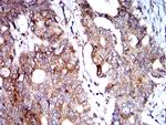 BNIP3 Antibody in Immunohistochemistry (Paraffin) (IHC (P))