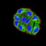 ADAM8 Antibody in Immunocytochemistry (ICC/IF)