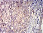 ADAM8 Antibody in Immunohistochemistry (Paraffin) (IHC (P))