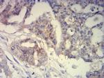 BCAM Antibody in Immunohistochemistry (Paraffin) (IHC (P))