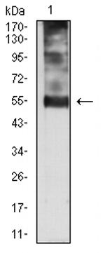 p57 Kip2 Antibody in Western Blot (WB)