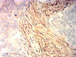 Calponin 3 Antibody in Immunohistochemistry (Paraffin) (IHC (P))