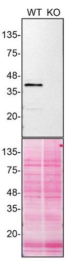 Calponin 3 Antibody in Western Blot (WB)