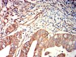 FGL1 Antibody in Immunohistochemistry (Paraffin) (IHC (P))