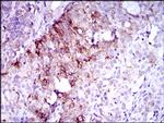 FLT3 Antibody in Immunohistochemistry (Paraffin) (IHC (P))