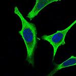 GABBR2 Antibody in Immunocytochemistry (ICC/IF)