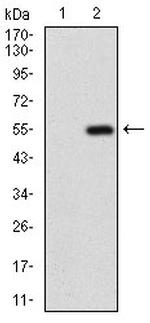 GABBR2 Antibody in Western Blot (WB)