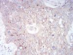 GLI1 Antibody in Immunohistochemistry (Paraffin) (IHC (P))