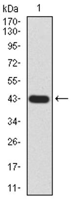 GLI1 Antibody in Western Blot (WB)