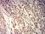 GSTP1 Antibody in Immunohistochemistry (Paraffin) (IHC (P))