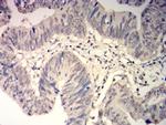 GSTP1 Antibody in Immunohistochemistry (Paraffin) (IHC (P))