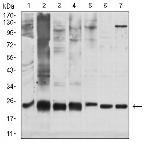 GSTP1 Antibody in Western Blot (WB)