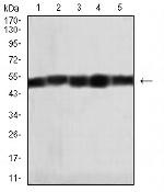 HAS1 Antibody in Western Blot (WB)