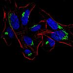 HDAC4 Antibody in Immunocytochemistry (ICC/IF)