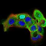 HSF1 Antibody in Immunocytochemistry (ICC/IF)