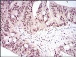 HSF1 Antibody in Immunohistochemistry (Paraffin) (IHC (P))